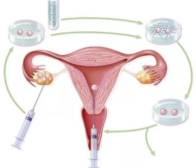 重庆地区有哪些私立的机构可以做试管技术？老人排卵期在下半月怀男孩几率大？