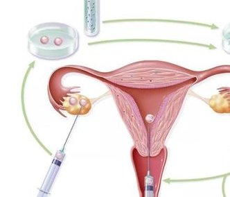 女性梦到试管生孩子孩好不好？梦见自己试管生了个孩子预示对助孕有期待？